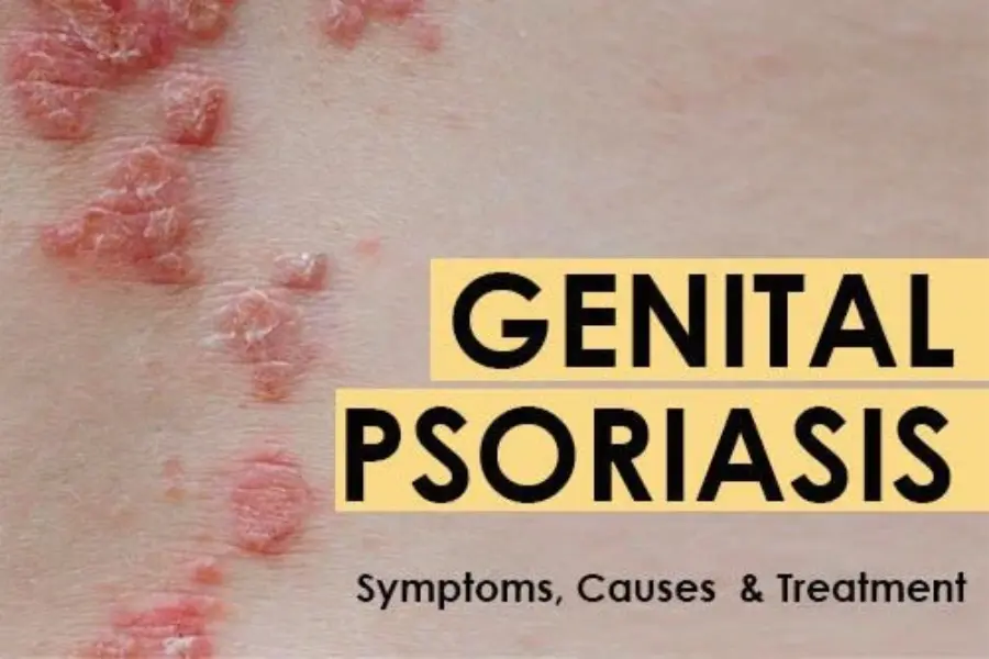 Male Genital Skin Conditions|Skin specialist in Ghatkopar