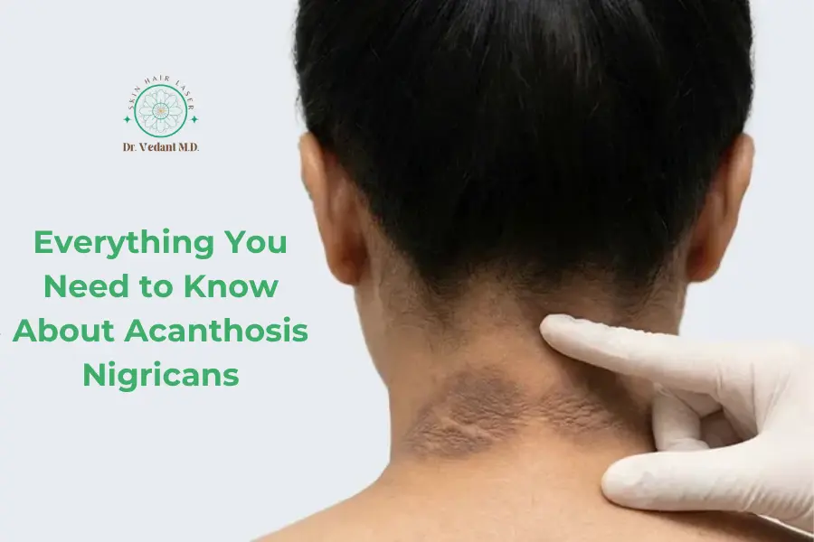 A Guide to Acanthosis Nigricans|Dermatologist Near Me Skin