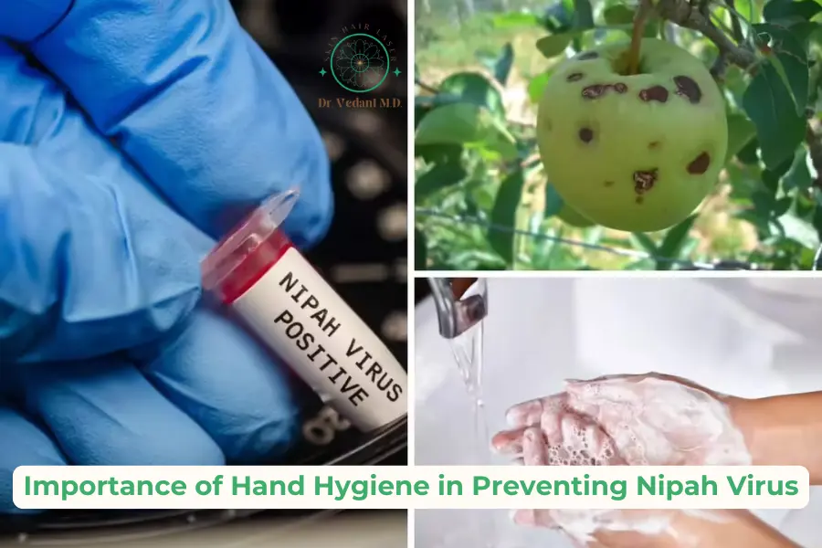 Hand Hygiene Benefits|Nipah Virus|Dermatologist Near Me