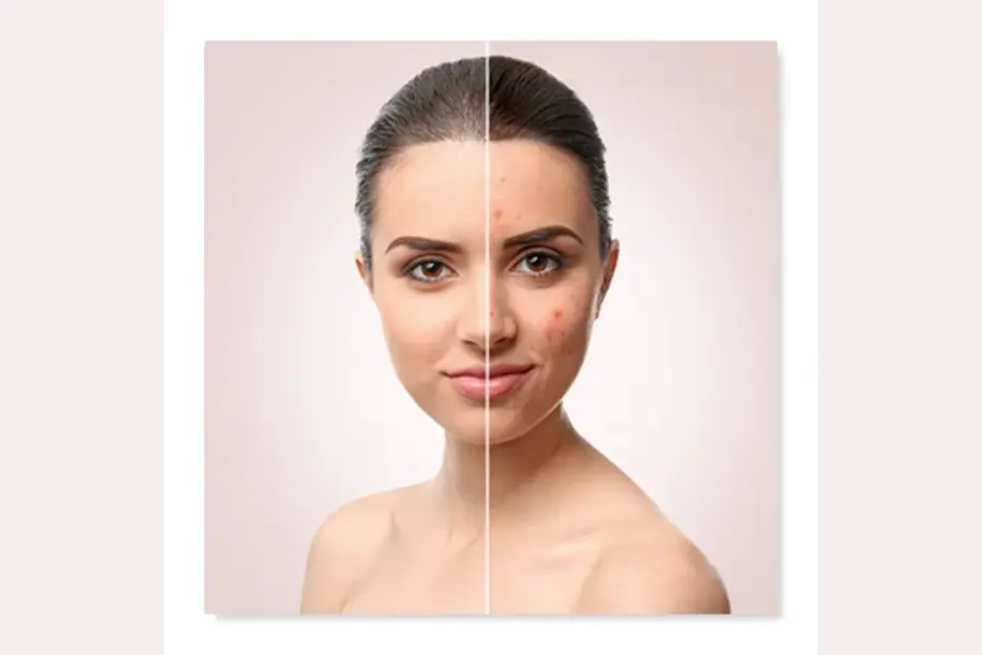 Venereology & Dermatology Difference|Skin Clinic in Chembur